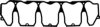VICTOR REINZ 71-36002-00 Gasket, cylinder head cover